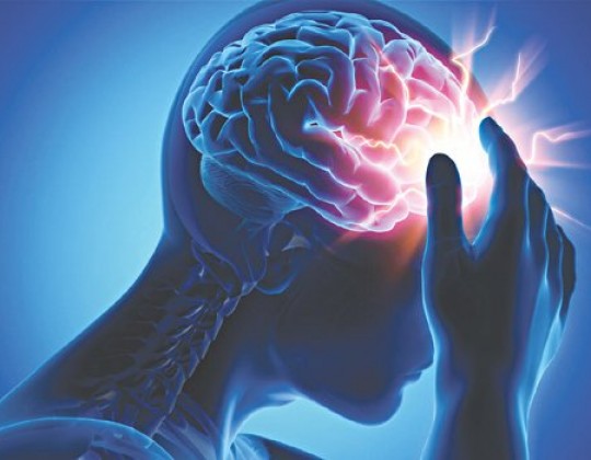 Kiến thức về đột quỵ não – Phương pháp sơ cứu, điều trị và phòng bệnh tái phát