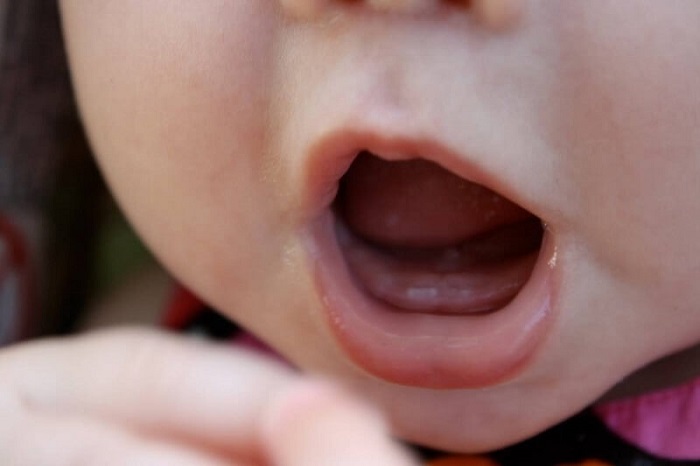 Nguyên nhân khiến trẻ chậm mọc răng